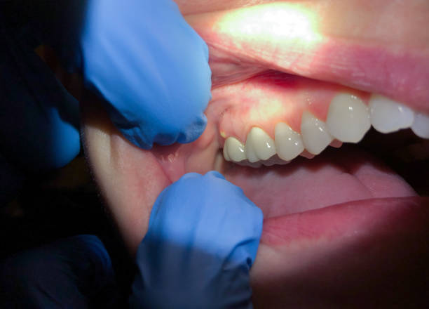 Best Cosmetic Emergency Dentistry in Ofallon, IL